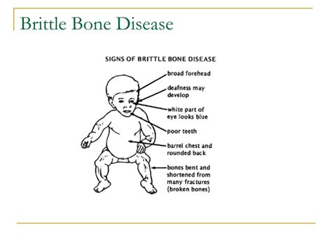 jilibee.oi|brittle bone disease life expectancy.